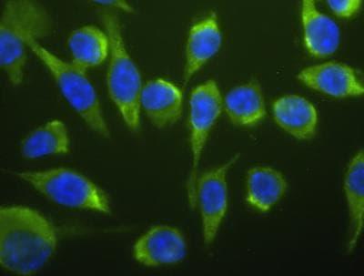 Novus Lightning-Link Fluorescein Antibod