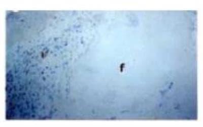 Novus CLEC10A/CD301 Antibody (121A5.01),