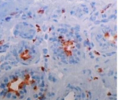 Novus DC-SIGNR/CD299/CLEC4M Antibody (12
