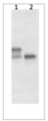 Novus IL-17/IL-17A Antibody (408H6.01/mA