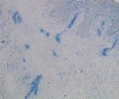 Novus Langerin associated lectin Antibod