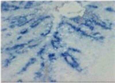 Novus CCL20/MIP-3 alpha Antibody (206D9.
