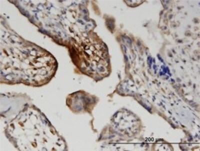 Novus Wnt-5a Antibody (3A4), 0.1 mg