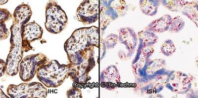 Novus HIF-2 alpha/EPAS1 Antibody, 0.1 ml