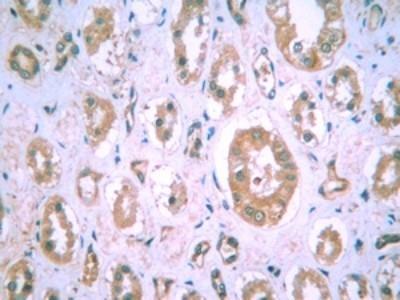 Novus HIF-1 alpha Antibody (H1alpha67),