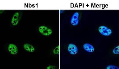 Novus Nbs1 Antibody, 0.05 ml