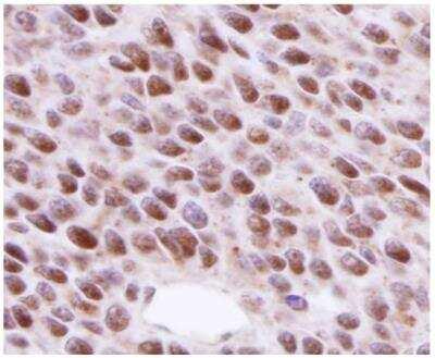Novus Rad51 Antibody (14B4), 0.1 mg