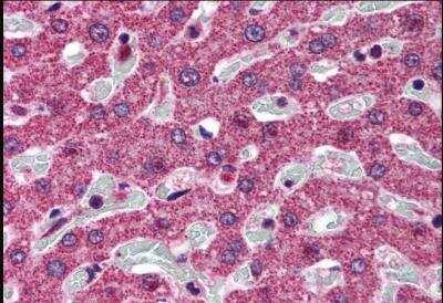 Novus SRD5A1 Antibody, 0.1 mg