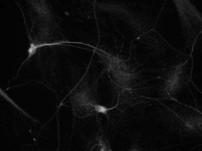 Novus Tubulin Beta 3 Antibody, 0.25 ml