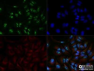 Novus DDX21 Antibody, 0.1 ml