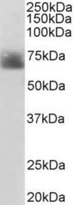 Novus Serotonin transporter Antibody, 0.