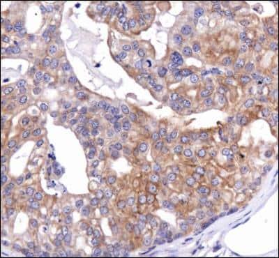 Novus Calnexin Antibody, 0.1 ml