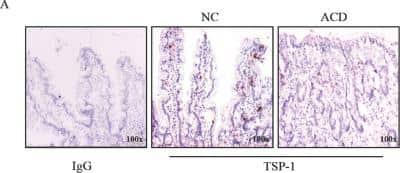 Novus Thrombospondin-1 Antibody (A6.1),