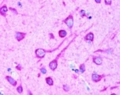 Novus LC3B/MAP1LC3B Antibody, 0.1 ml