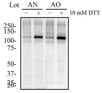 Novus IRE1 alpha [p Ser724] Antibody, 0.