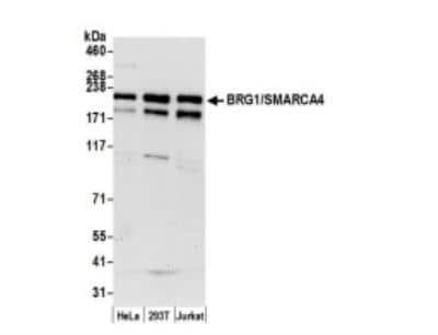 Novus Brg1 Antibody, 0.1 ml