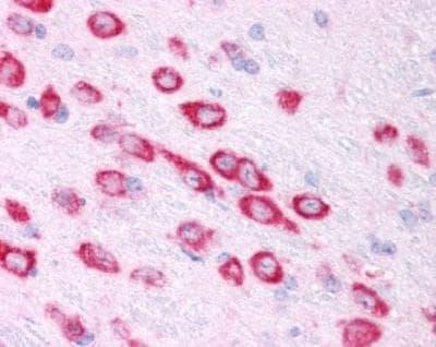 Novus HIF-1 alpha Antibody, 0.1 ml