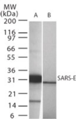 Novus Sars Envelope Protein Antibody, 0.