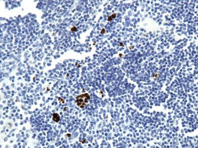 Novus VEGF Antibody (VG76e), 0.1 ml