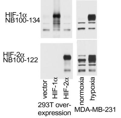 Novus HIF-1 alpha Antibody Pack, 5 Vials