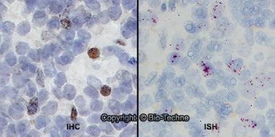 Novus Integrin alpha M/CD11b Antibody, 0