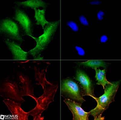 Novus SR-BI Antibody, 0.1 ml