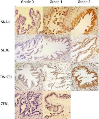 Novus ZEB1 Antibody, 0.1 ml
