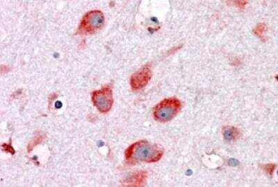 Novus RPL22 Antibody, 0.1 mg