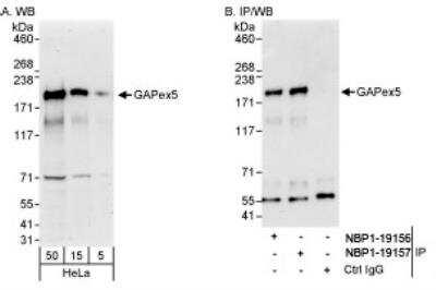 Novus RAP6 Antibody, 0.1 ml
