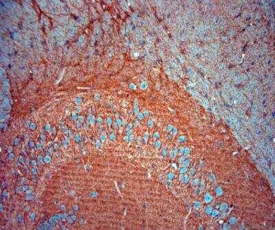 Novus EAAT2/GLT1 Antibody, 0.1 ml