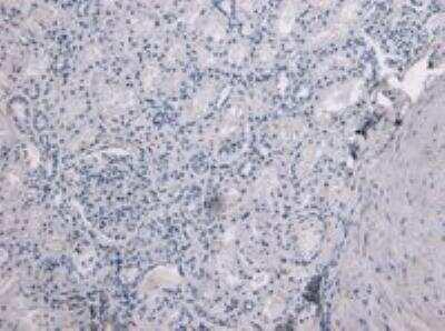 Novus TMPRSS2 Antibody, 0.1 mg