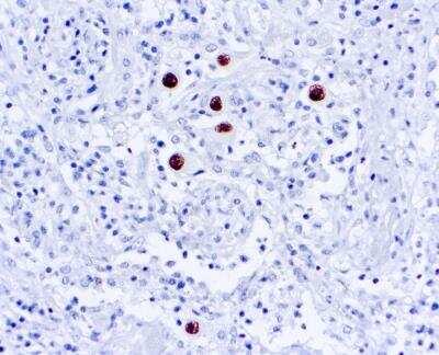 Novus Cytomegalovirus Antibody (DDG9 and