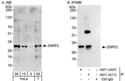 Novus ZNRF2 Antibody, 0.1 mg