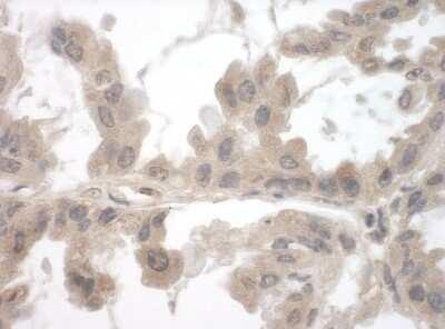 Novus FNBP1L Antibody, 0.1 mg