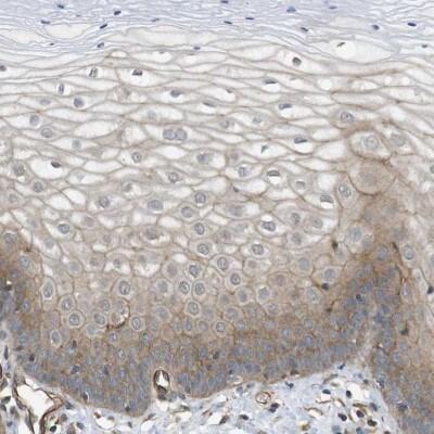 Novus ZDHHC5 Antibody, 0.1 ml