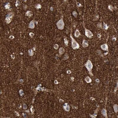 Novus Versican Antibody, 0.1 ml