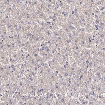 Novus WASH3P Antibody, 0.1 ml