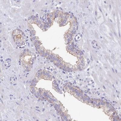 Novus VP26B Antibody, 0.1 ml
