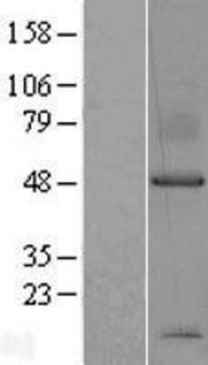 Novus Syndecan-1/CD138 Overexpression Ly