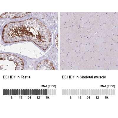 Novus DDHD1 Antibody, 0.1 ml