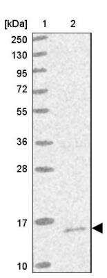 Novus Mitochondrial Ribosomal Protein S1