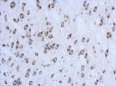 Novus CKAP4/p63 Antibody, 0.1 ml