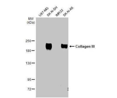 Novus Collagen III alpha 1/COL3A1 Antibo