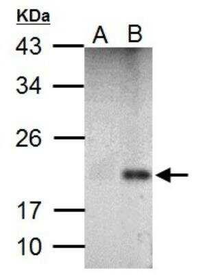 Novus p21/CIP1/CDKN1A Antibody, 0.1 ml