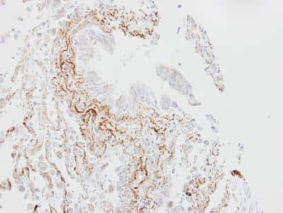 Novus SGLT1/SLC5A1 Antibody, 0.1 ml