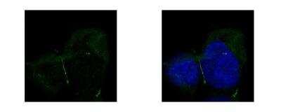 Novus Tight Junction Protein 1 Antibody,