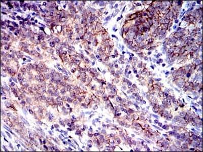 Novus CD9 Antibody (5G6), 0.1 ml