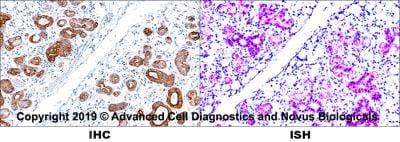 Novus pan Cytokeratin Antibody (AE1 + AE