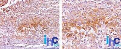 Novus PMEL17/SILV Antibody (NKI-beteb) [