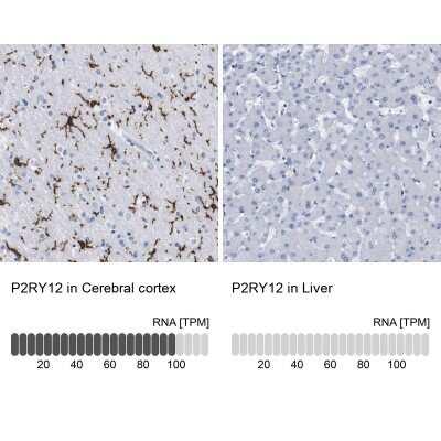 Novus P2Y12/P2RY12 Antibody, 0.1 ml